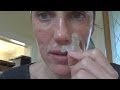 Najlakši način da se riješite mitisera i akni (VIDEO)