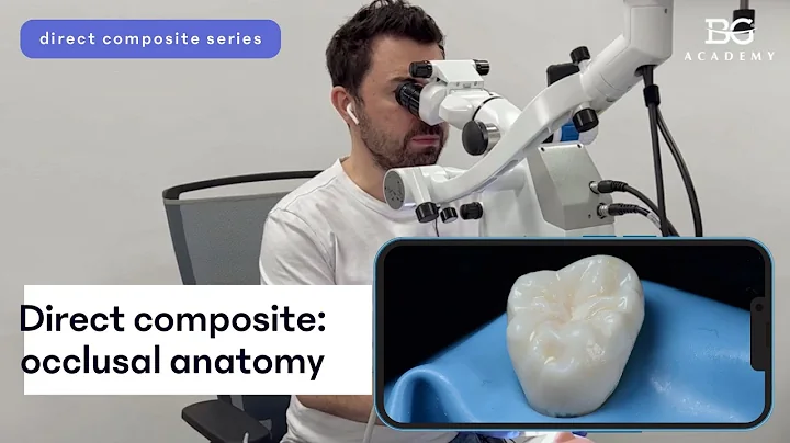 Direct composite: occlusal anatomy