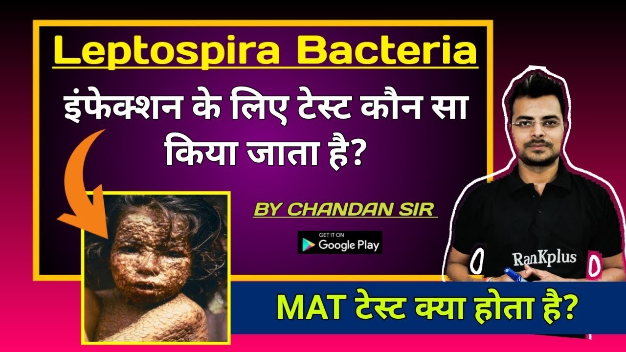leptospirosis microbiology | leptospirosis in hindi | leptospirosis igm test | chandanmlt