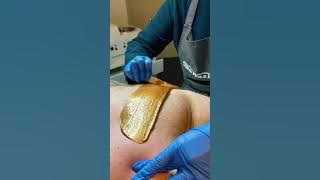 Brazilian wax satisfying🤤💅 buttwax bikini waxing💅