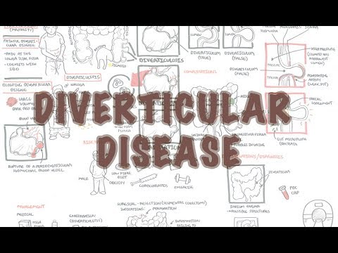 Video: Psykologiske Og Arbejdsrelaterede Resultater Efter Patienter I Multidisciplinær Rehabilitering Af Kroniske Lændesmerter: En Potentiel Randomiseret Kontrolleret Undersøgelse