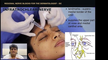 Nerve Blocks on the Face & Scalp - Supraorbital, Greater  Occipital, Infraorbital, Mental etc