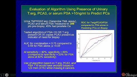 Refining Early Detection and Predicting Outcomes of Primary Treatment - Martin Sanda, MD