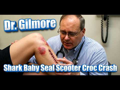 Shark Baby Seal Scooter Croc Crash