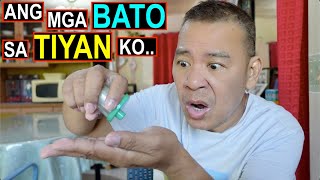 GRABEHH! Ang mga BATO na NAKUHA sa TIYAN Ko..😯🙏 TINANGGAL na din po ang GALLBLADDER Ko. by ROBATOLOGY 19,543 views 3 weeks ago 17 minutes