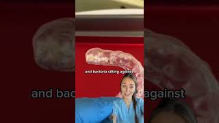 What will happen if you don't clean retainer for a week?