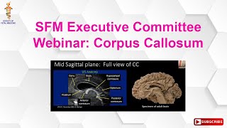 SFM Executive Committee Webinar: Corpus Callosum