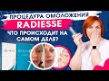 RADIESSE ОМОЛОЖЕНИЕ . Что происходит на самом деле?  КОНТУРНАЯ ПЛАСТИКА ФИЛЛЕРОМ.