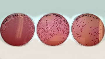 3. Level 3 Microbiology | Microbiology analysis of beef