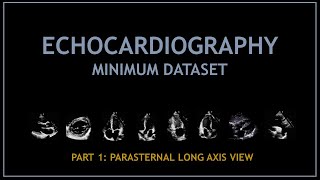 Echocardiogram: Minimum dataset (PART 1: parasternal long axis view)