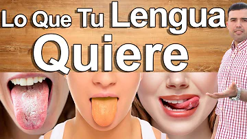 ¿Por qué tengo la lengua amarilla y blanca?