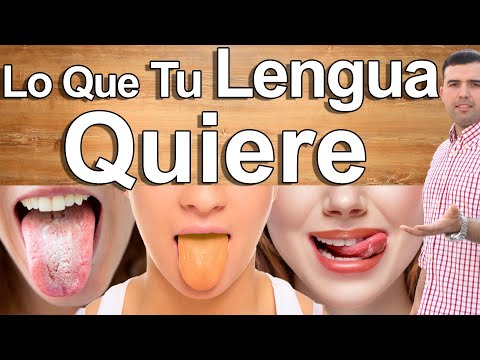 Vídeo: Lengua Morada: Qué Significan Las Manchas De Color Púrpura O Azulado En La Lengua