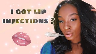 I GOT LIP FILLERS PRANK ON MY GF!