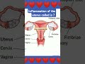 inflammation of the uterus called is || #shorts #medical #biology #nursing