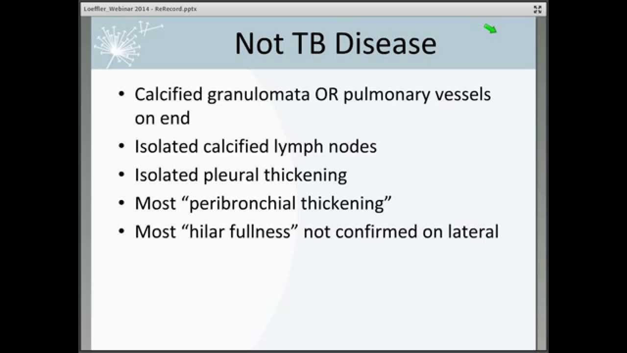 Pediatric Tuberculosis: The Essentials