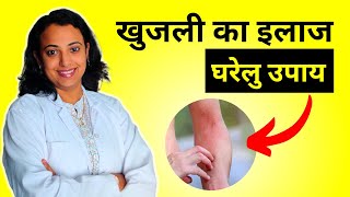 Itchy Skin Treatment in Hindi - Home Remedies