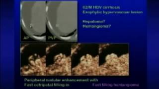 Beyond Morphology Quantitative Ultrasound in the Liver screenshot 4