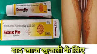 Ketomac Plus Uses In Hindi दद खज खजल म इसतमल कए जन वल मडसन