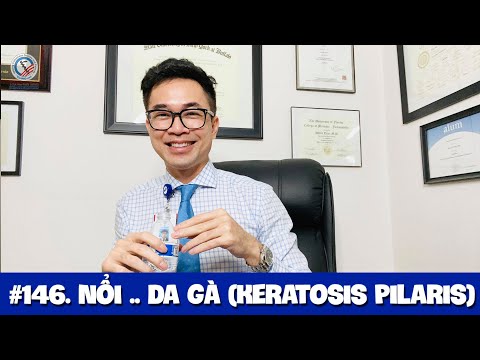 #146. Bệnh nổi...da gà (Keratosis Pilaris or Chicken Skin)