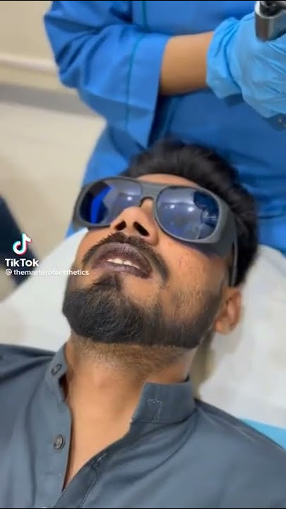 Black lips turn in to pink - laser treatment- satisfying #watch #laser