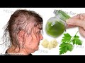 Your hair will grow 5 times faster,🌿Get rid of baldness quickly, A final solution, hair growth oil