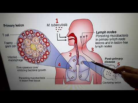 Video: Decifrare La Resistenza Ai Farmaci Nel Mycobacterium Tuberculosis Usando Il Sequenziamento Dell'intero Genoma: Progresso, Promessa E Sfide