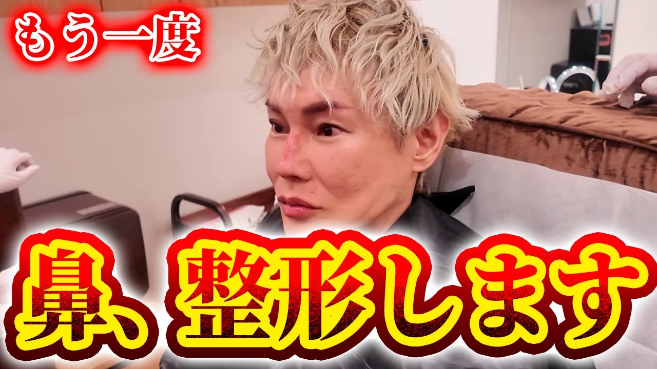 【鼻整形】まさかの、再オペ？!整形シミュレーションしたらカッコ良すぎた。