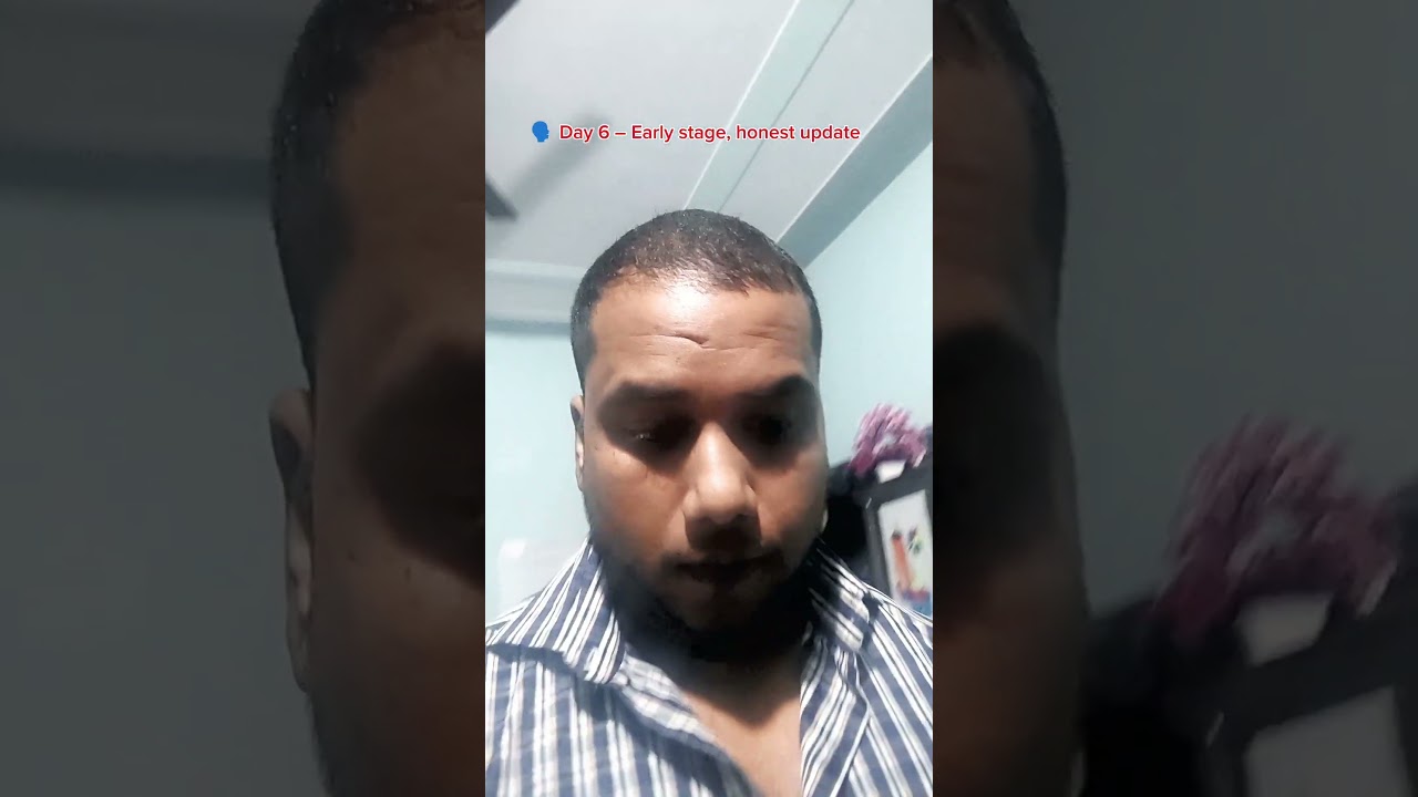 Plix Rosemary Hair Spray Day 6 | Daily Use Continues