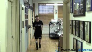 Partial Foot Amputee Walks For The First Time