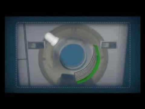 Vídeo: Tomografia Computadorizada Espiral