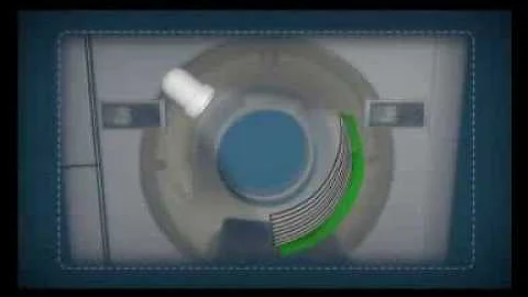 Qual a diferença entre tomografia convencional para tomografia helicoidal?