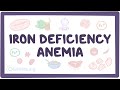 Iron deficiency anemia - causes, symptoms, diagnosis, treatment, pathology