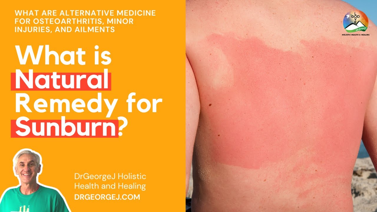 What are Natural Remedies for Sunburn? | Alternative Medicine | DrGeorgeJ
