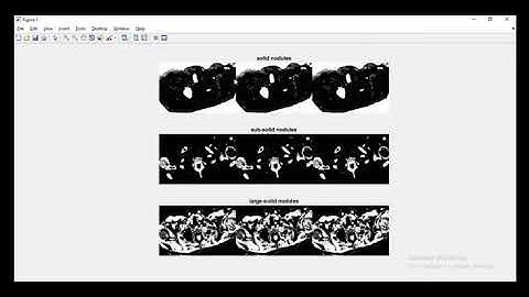 Lung segmentation matlab projects | Lung segmentation matlab Thesis