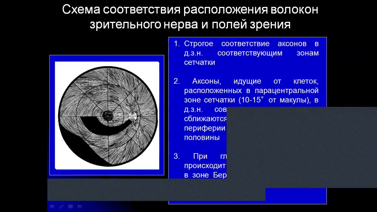 Заболевания зрительного нерва