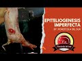 Reseñando: Epiteliogenesis imperfecta // Porcícola del Sur
