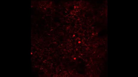 Simulated Multi-photon Resonant Scan Acquisition of Neurons with NEX-tdTomato