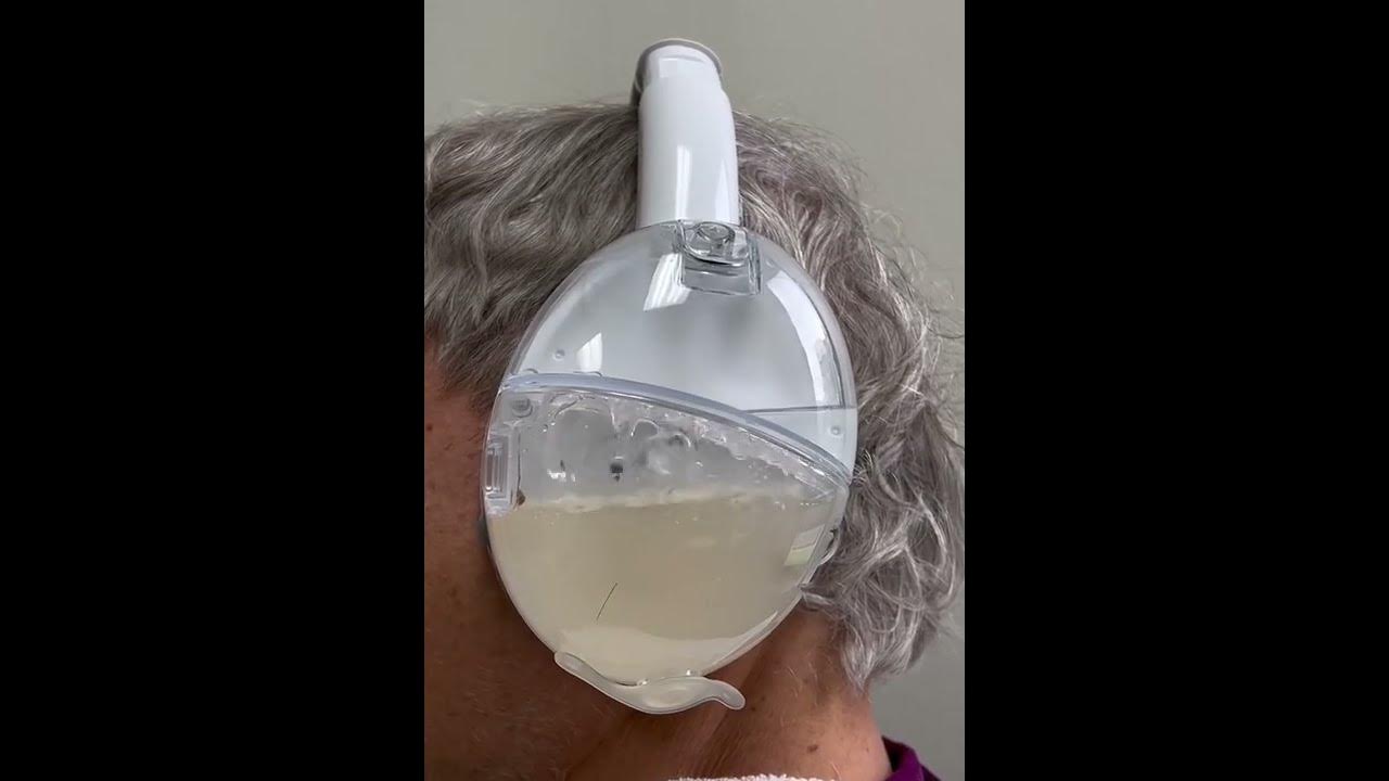 FDA-Cleared OtoSet® Ear Cleaning System - Earwax Removal Procedure