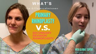 How Is A Revision Different From A Primary Rhinoplasty By A Global Expert Dr. Rohrich