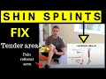 Fast Shin Splints Cure Exercise