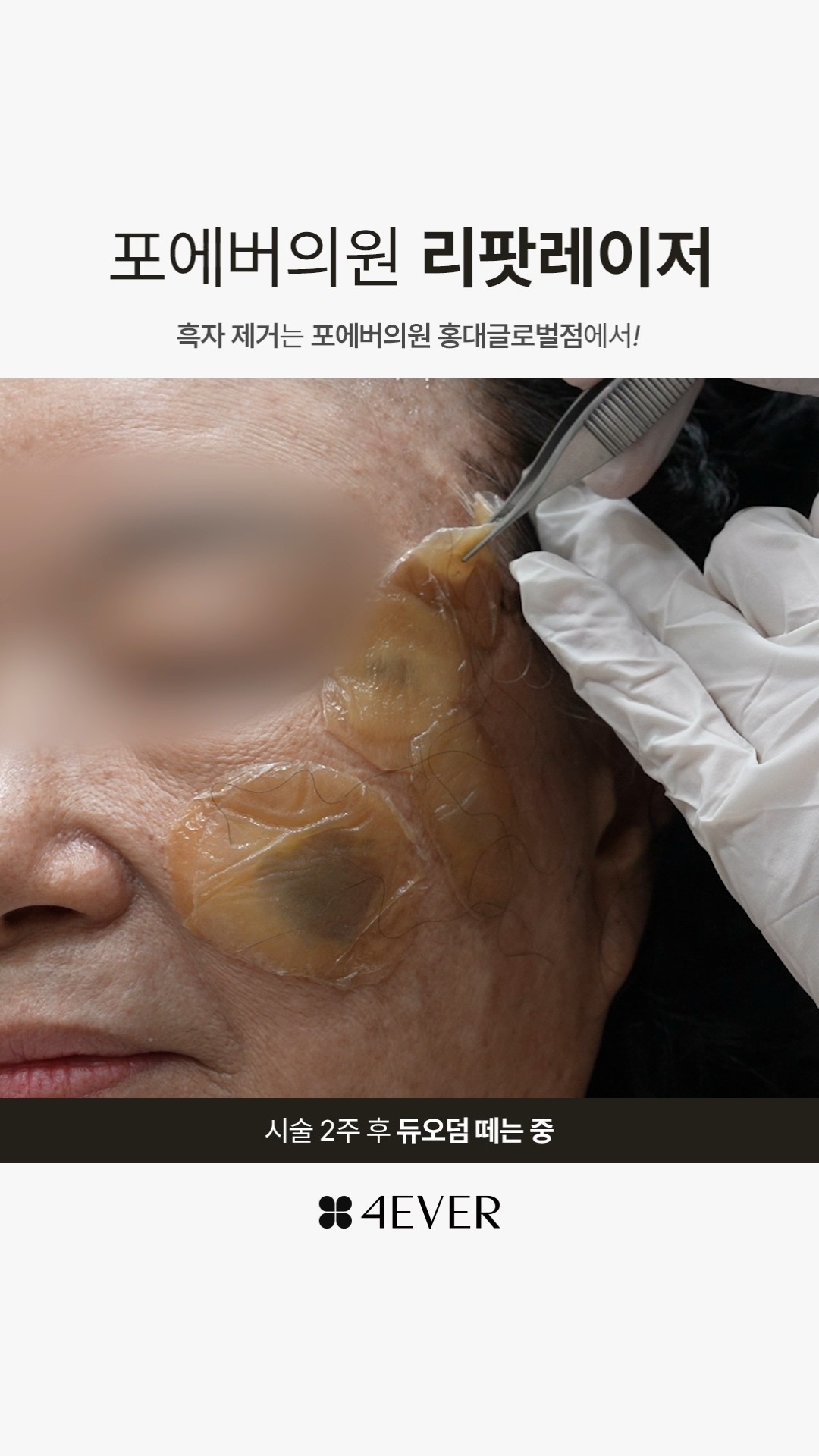 쇼츠