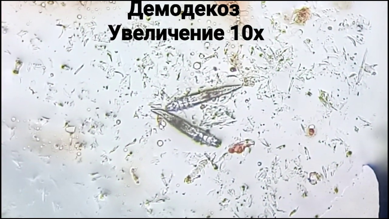 Демодекоз у собак схема