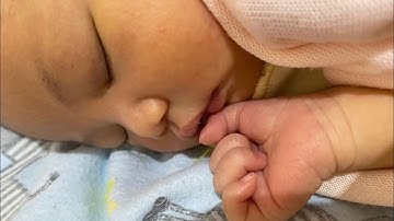 Bayi lahir dengan ibu mengalami Hepatitis B