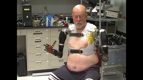 Amputee Makes History with APLs Modular Prosthetic Limb