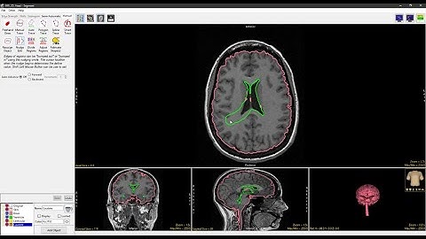 Analyze 15.0 - Segment: Nudge Edit