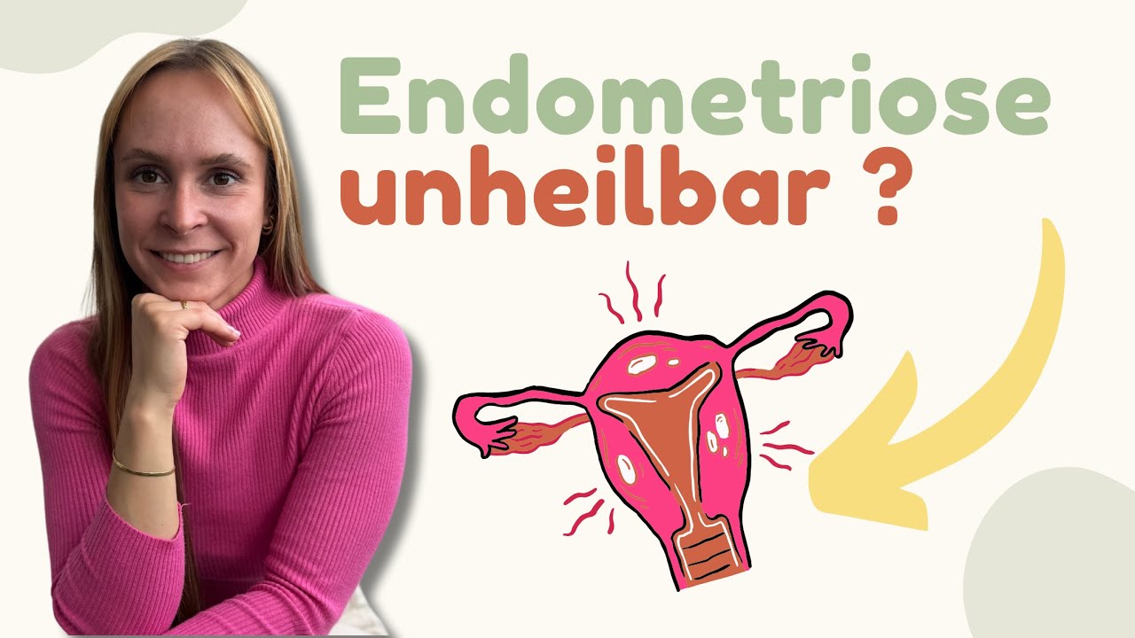 Diese Behandlungen wirken bei Endometriose!