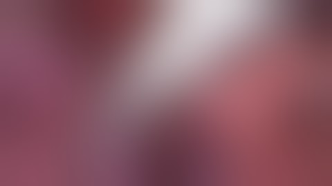 Laparoscopic cholecystectomy in a patient with  Liver Cirrhosis by Dr Hitesh Chavda