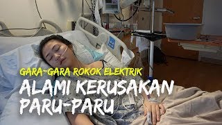 Gara-gara Rokok Elektrik, Perempuan Ini Alami Kerusakan Paru-paru