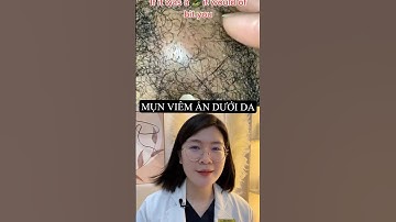 Review - Mụn khủng lồ ẩn dưới da ở vùng ấy #thsbsphuongquy #review #reaction #shorts