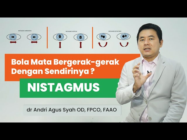 NISTAGMUS Mata Bergerak-Gerak Dan Susah Fokus - VIO Optical Clinic class=
